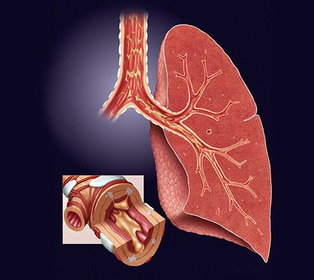 LUNG